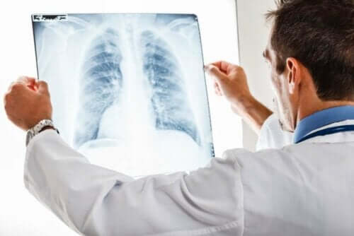 Doktor tittar på röntgenbild av lunga.