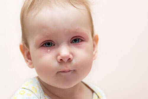 Ögoninflammation hos barn: vad kan du göra?