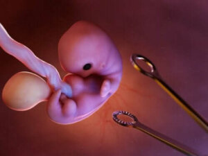Inducerad abort: vad handlar det om?