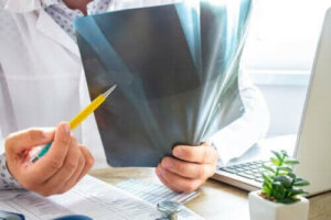 Ödem i benmärgen: allt du behöver veta