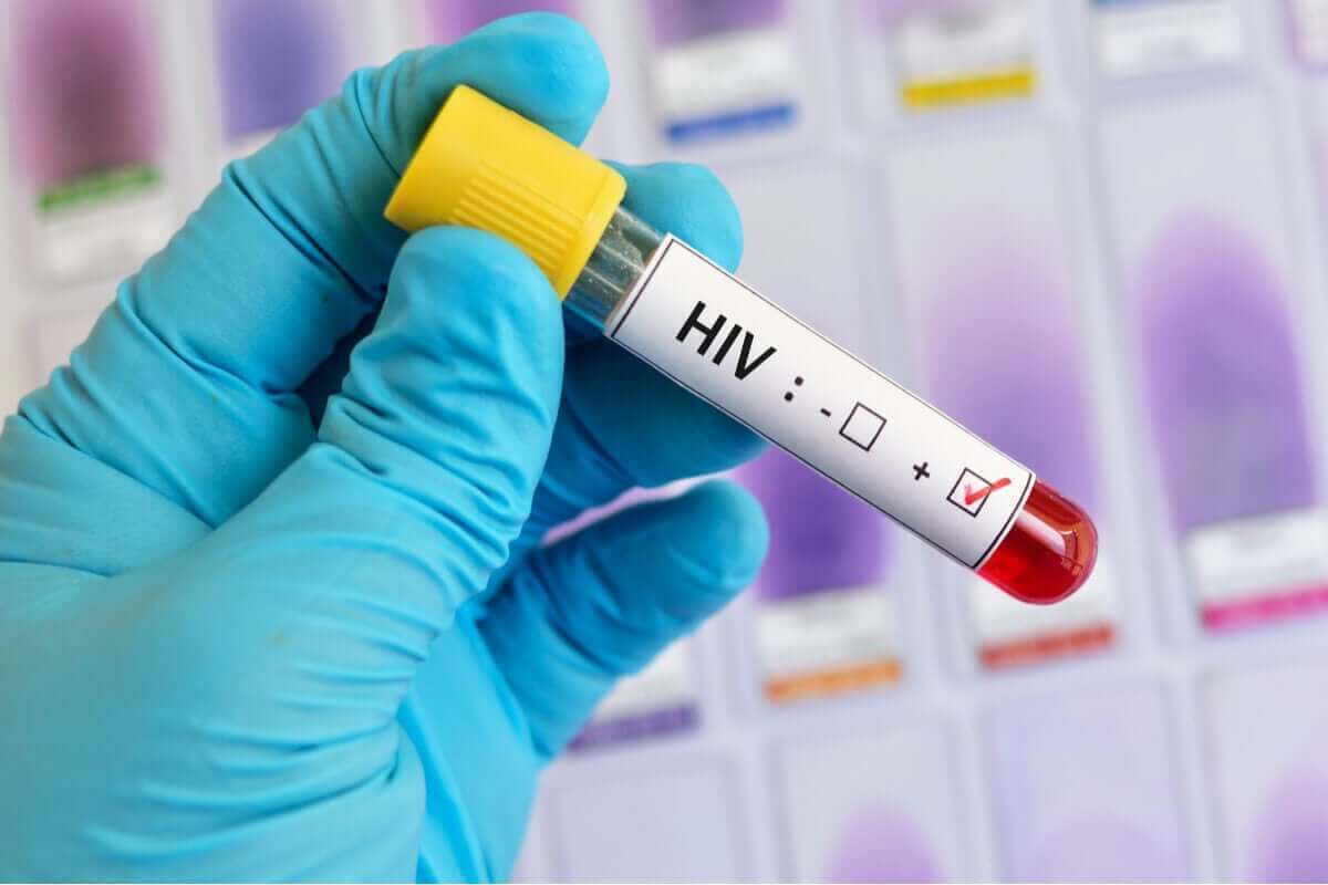 prov med HIV