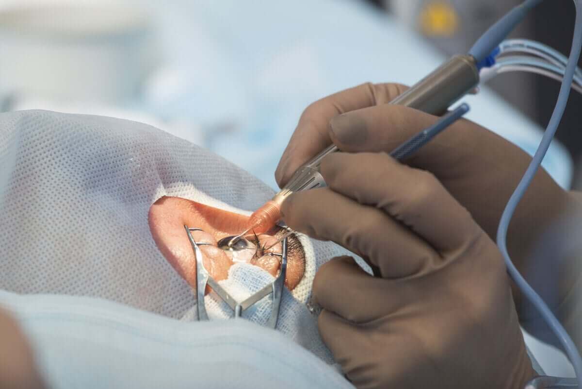 operation för att motverka förlust av synen