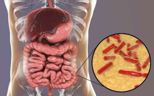 Hur man vet om tarmens mikrobiom är skadat