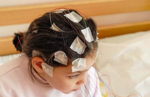 Epilepsi hos barn: barn med elektroder på huvudet