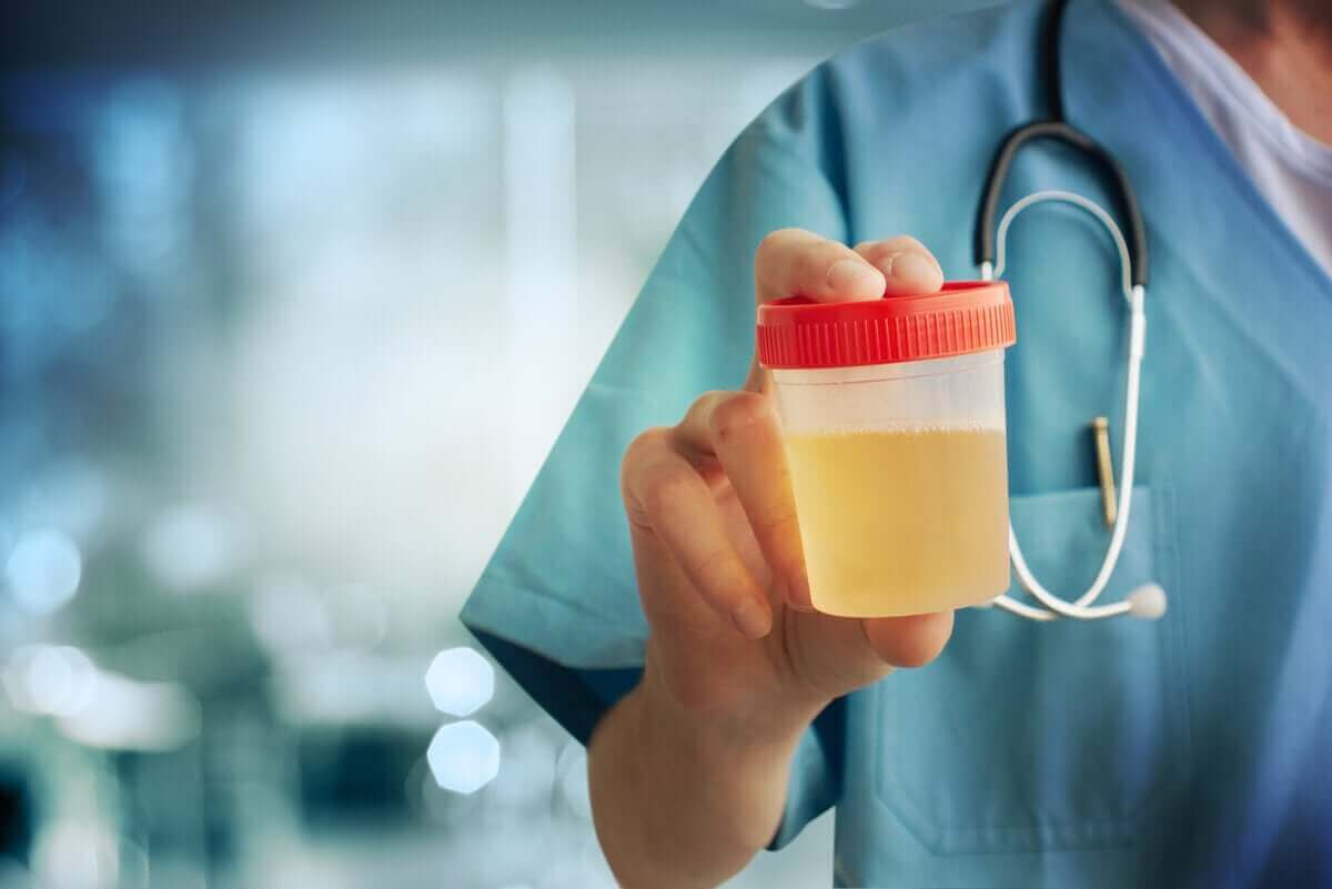 läkare ska göra odling av urin