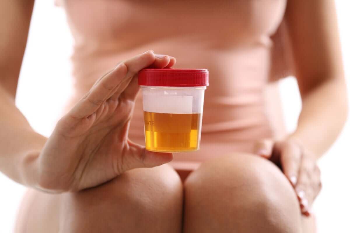 odling av urin: kvinna med urinprov