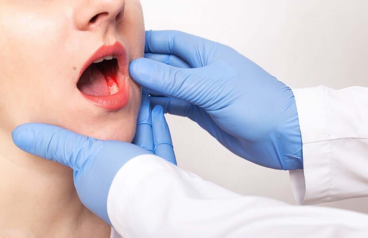 läkare undersöker sjukdom i tandköttet