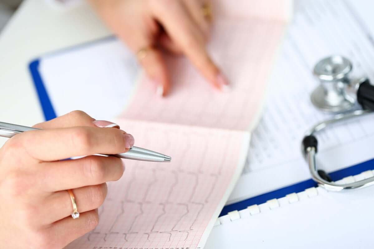 ekg