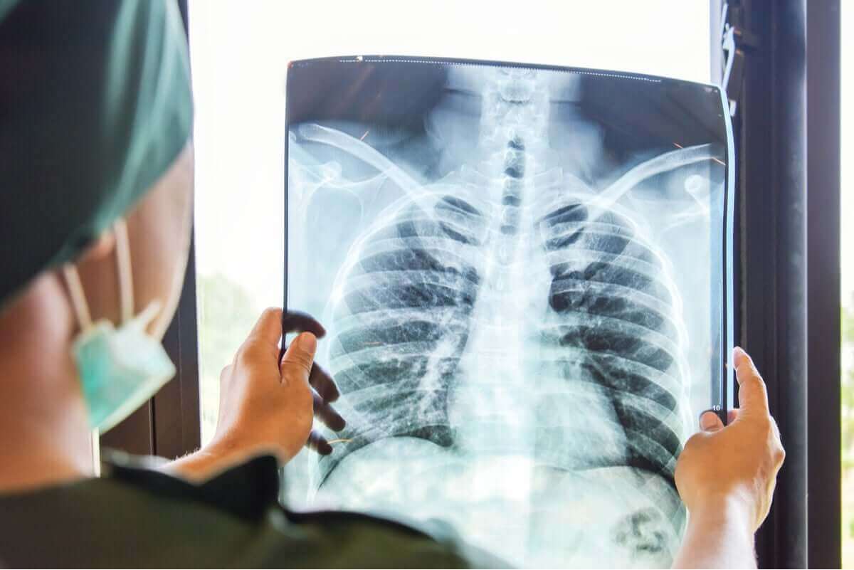 röntgenbild av lungor