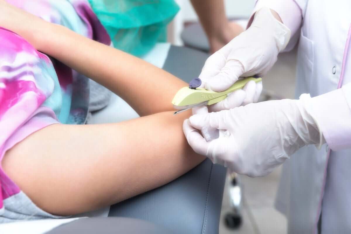 insättning av p-stav