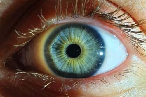 Uppspärrat öga med gul ring runt pupillen.