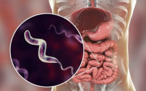 Symtom på campylobacterinfektion