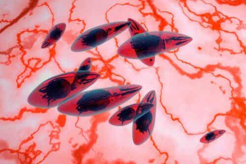 Toxoplasma är en parasit som orsakar toxoplasmos i alla dess typer, inklusive den okulära.