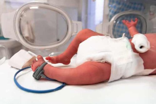 En för tidigt född baby.