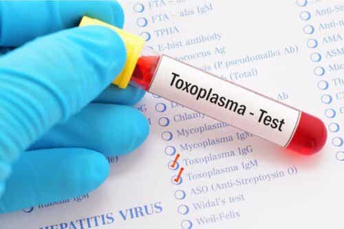 En blodserologi för toxoplasmos är en indikation på kontakt med parasiten men bekräftar inte sjukdom.