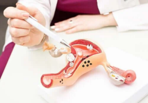Graviditetskomplikationen cervixinsufficiens: symptom