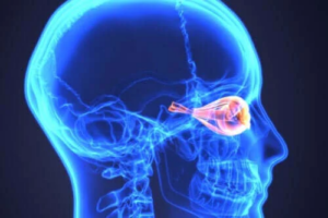 Neuromyelitis optica eller Devics sjukdom: Vad är det?