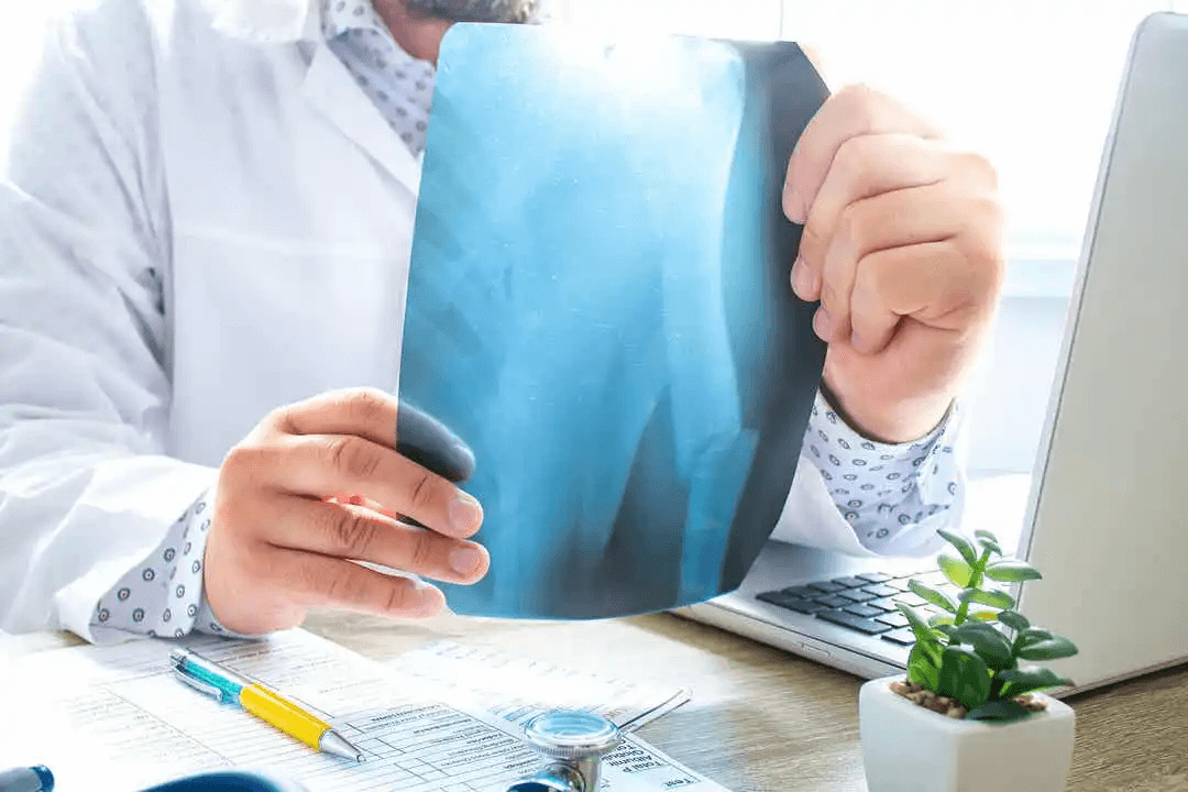 en reumatolog tittar på röntgenbilder