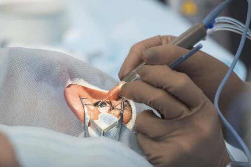 En patient som genomgår en ögonoperation.
