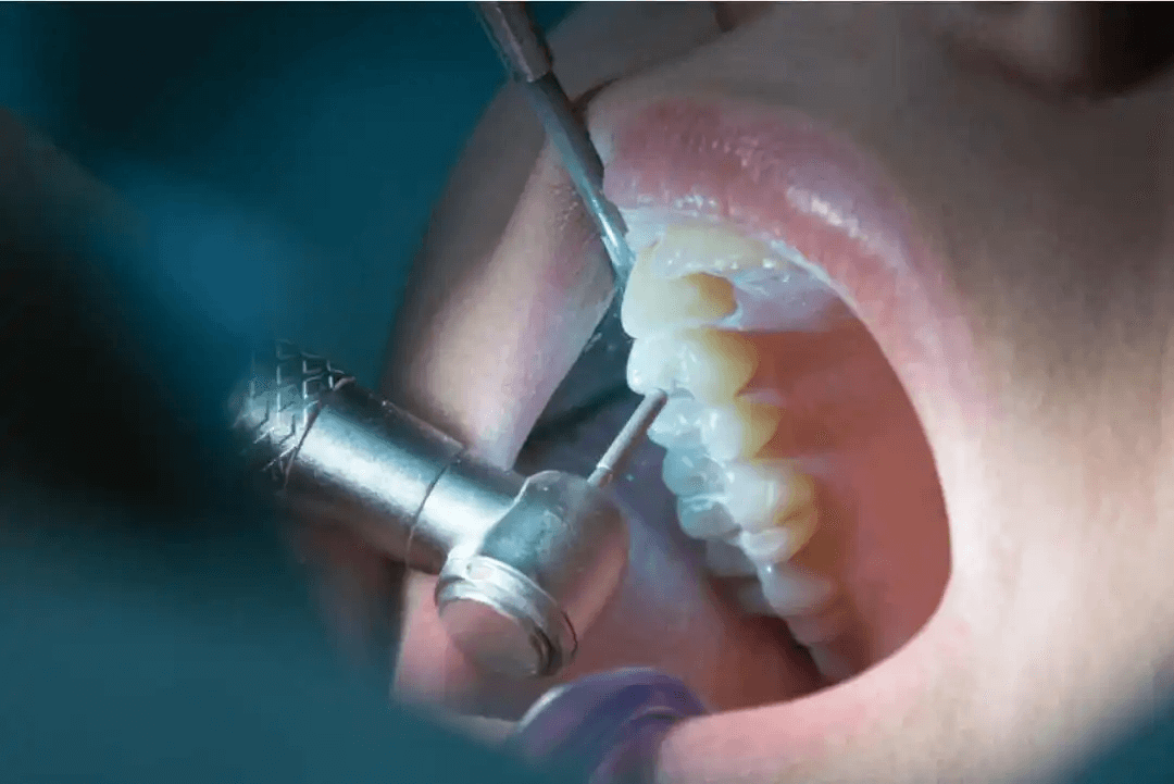 tandläkare utför lagning