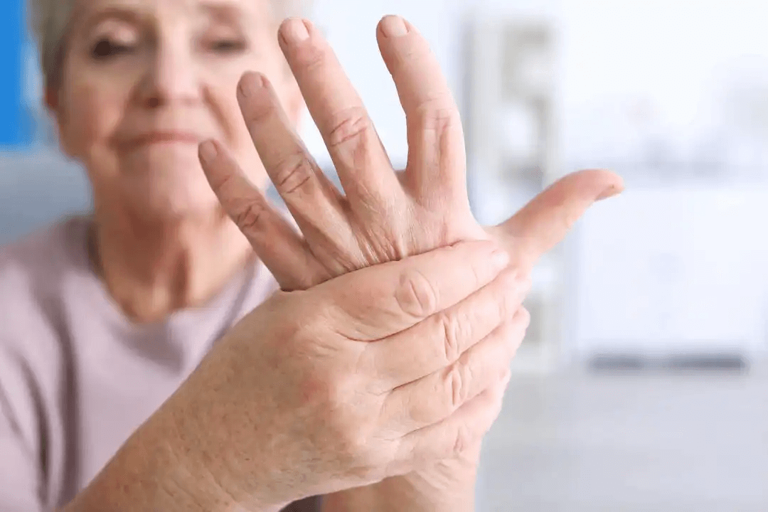 kvinna med artrit