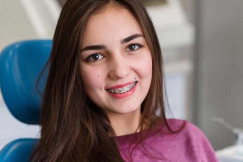 kvinna med tandställning