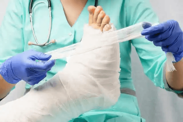 någon lägger gips på ben och fot