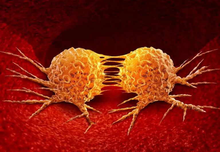 Möjliga tecken på cancer hos män och kvinnor