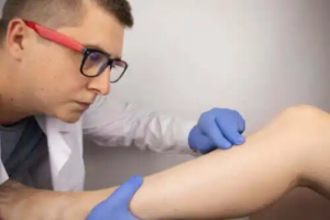 Benkontusion: Orsaker, symptom och behandlingar