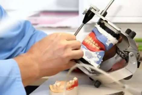 Dentala implantat och proteser: Vad de är och de olika typerna som finns