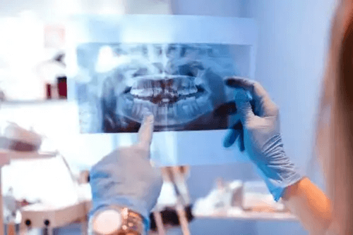röntgenbild av mun