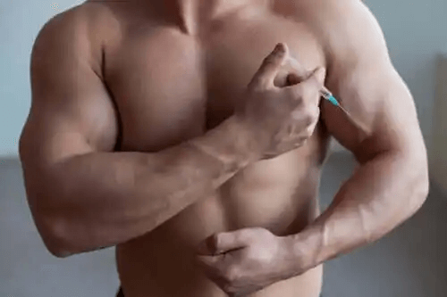 Palumboism hos kroppsbyggare: Effekten av steroider