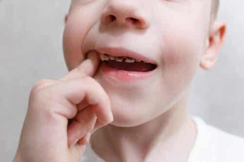Ett barn med dåliga tänder som visar kameran sina tänder
