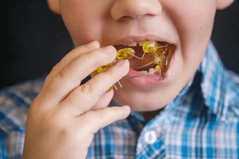 Interceptiv ortodonti: barn sätter in tandställning
