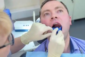 Fluor för tänderna: Hur hjälper det till att förhindra karies?