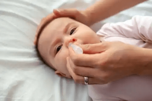 Symptom på respiratoriskt syncytialvirus hos spädbarn