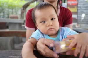 Möbius syndrom: Vad är det egentligen?