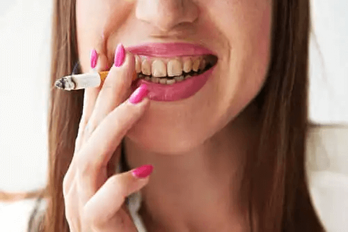 Melanos hos rökare: Symptom och behandling