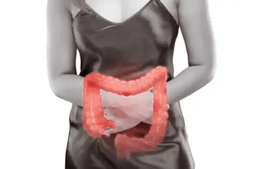 kvinna med ont i tarmen på grund av symptomatisk divertikulär stenos