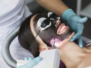 Laserpeeling med aktivt kol: Hur går det till?