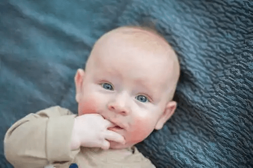 En bebis med atopisk dermatit i ansiktet.