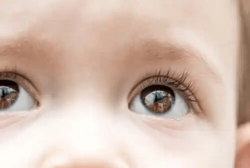 Fokus på primärt kongenitalt glaukom