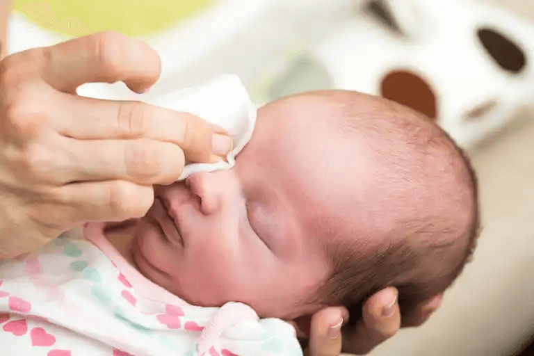 En bebis får sina ögon rengjorda