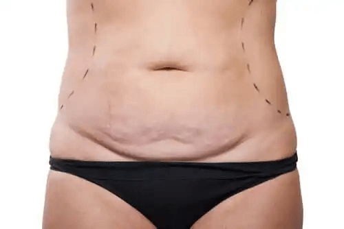 En kvinna som har gått upp i vikt under graviditeten.
