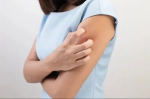 Atopiska eksem och hud: Vad är det och vad orsakar det?