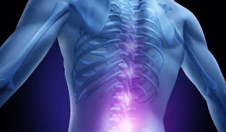 En person med smärta i nedre delen av ryggen.