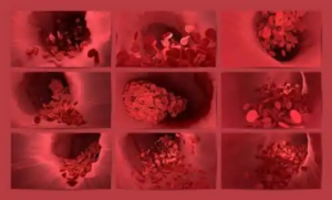Fibrinolys: processen som förhindrar att trombos bildas