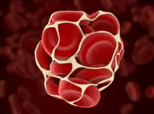 En illustration av en blodpropp som förhindras av fibrinolys
