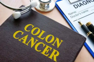 Världsdagen för kolorektalcancer: Testa dig!