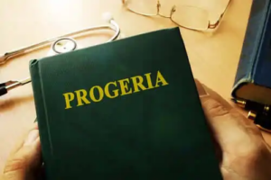 Werners syndrom: När en person åldras för snabbt